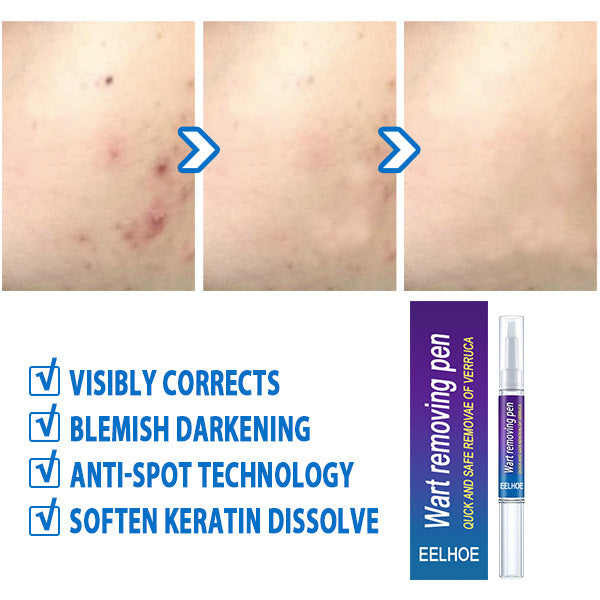 Keyou Skin care lotion Youchang Ping Liquid